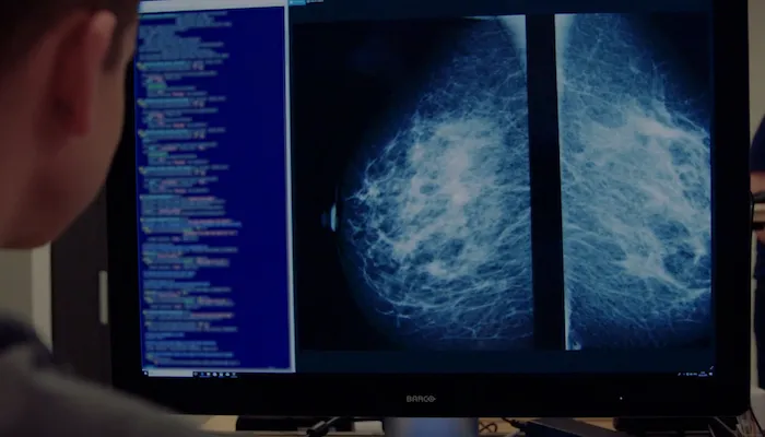 Kheiron Medical Technologies, Atlas Medical, AI, WHO, cancer diagnostics, machine learning